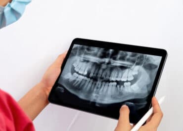Jak wygląda RTG zębów?