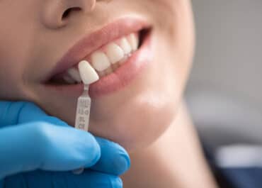 Od czego zależy cena implantów zębowych?
